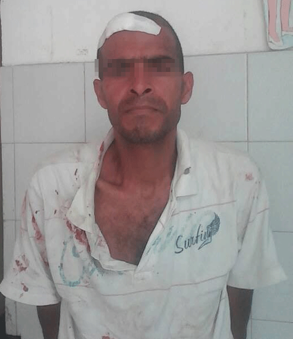 Polimunicipal salvó a un ladrón de ser linchado en La Guaira