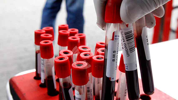 Hay donantes para los bancos de sangre pero reactivos