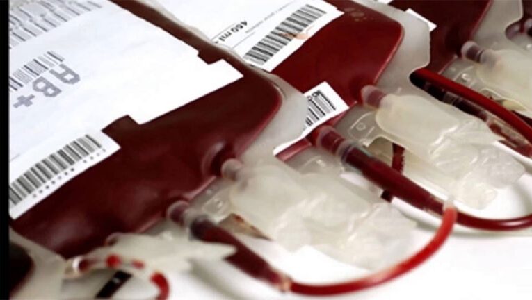 Antes de donar sangre deben esperar horas por la PDR en el Seguro