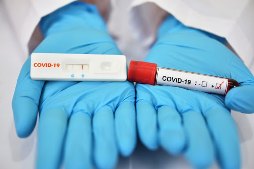 Se agotan pruebas diagnósticas para Covid-19