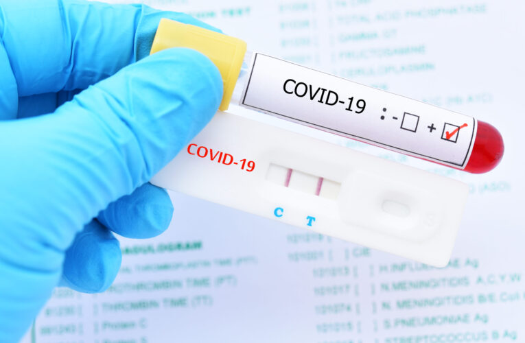 Pacientes con síntomas de Covid-19 no encuentran donde hacerse una prueba