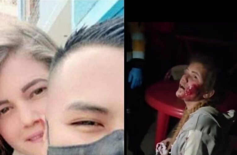 Policía peruano golpeó a su novia venezolana