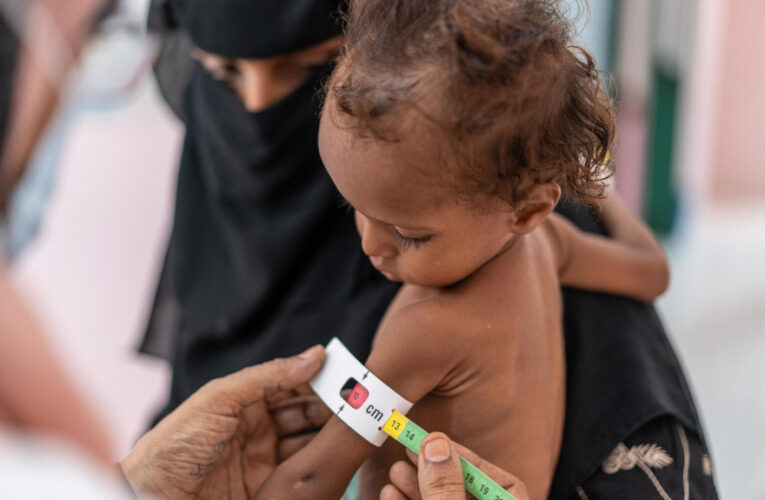 ONU: 45 millones están al borde de la hambruna