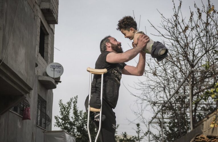 Padre e hijo sirios recibirán prótesis gracias a una foto viral