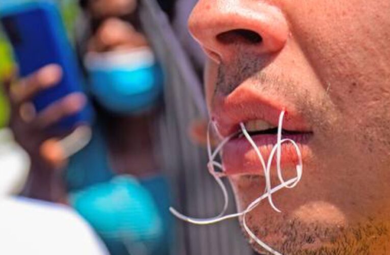 10 migrantes se cosieron los labios para exigir sus visados en México