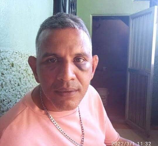 Policía Municipal junto a parientes golpearon a hombre en Canaima