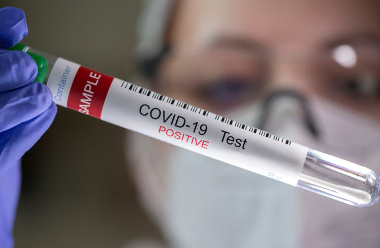 Venezuela registra 209 nuevos contagios de covid-19