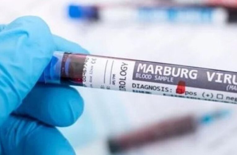 OMS: Nuevo virus de Marburgo es 88% letal