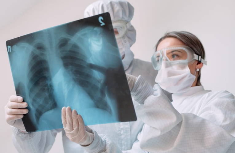46 trabajadores de la salud se infectaron de tuberculosis