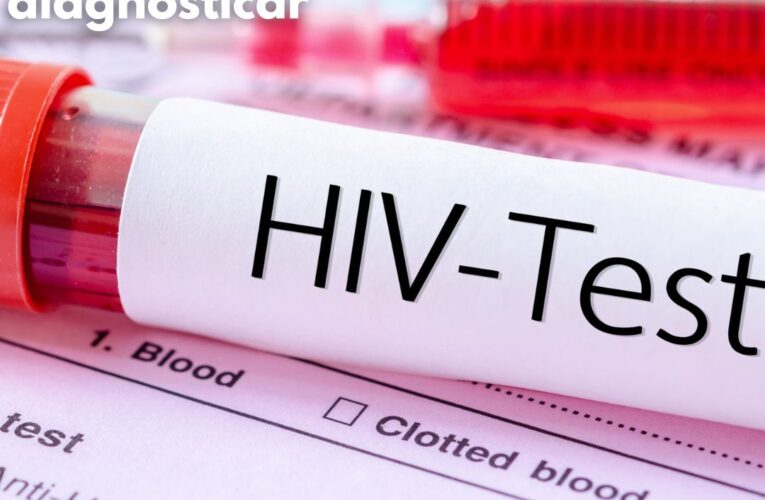 OMS alerta a Europa por aumento de VIH sin diagnosticar