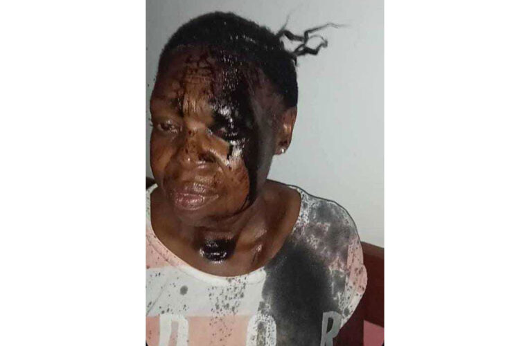 Ex GNB agredió a mujer de tercera edad que ahora está aterrada