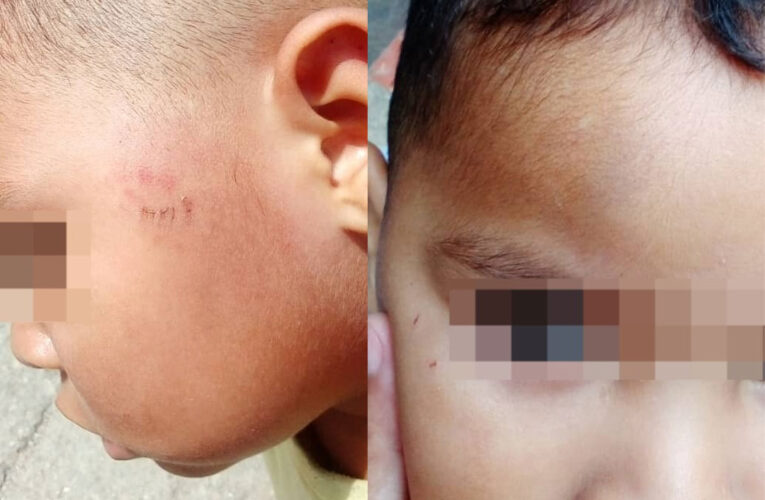Niño de 2 años es agredidoen el CEIS Los Olivos