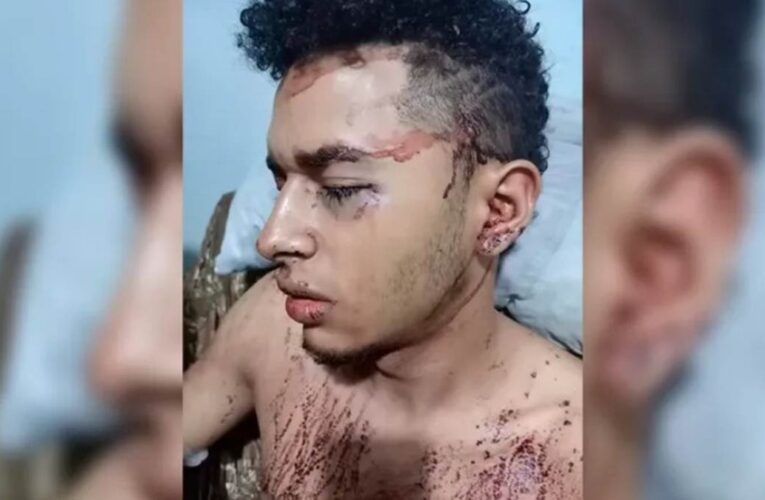 Venezolano recibió brutal golpiza en Perú