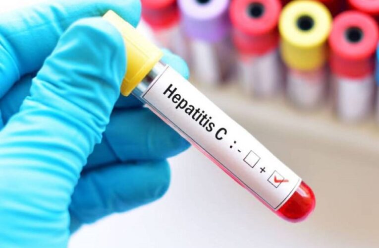 Advierten brote de hepatitis C en unidades de diálisis en Venezuela