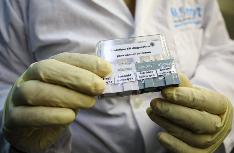 Científicos venezolanos elaboran kit de diagnóstico de cáncer de mama