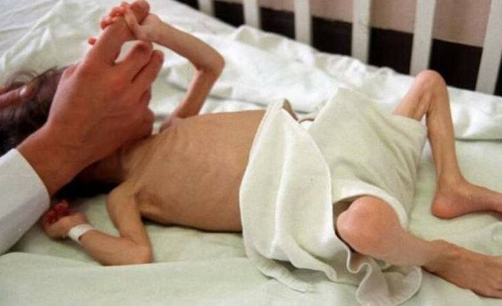 Madres desnutridas procrearán hijos débiles con problemas de salud