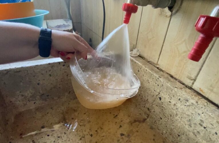 El agua contaminada provoca tiña y erisipela