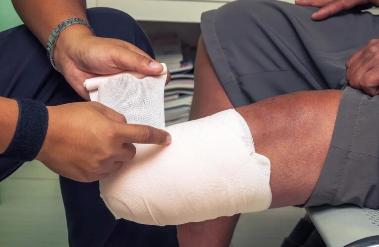 Muchos motorizados sufren infecciones y son amputados…para siempre