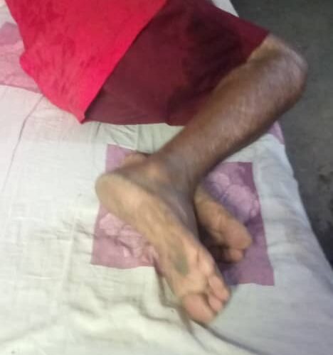 Pide ayuda  para su hermano discapacitado