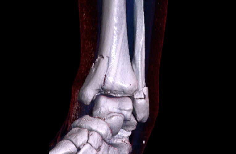 Joven quedará lisiado si la ayuda de Suárez se retrasa más