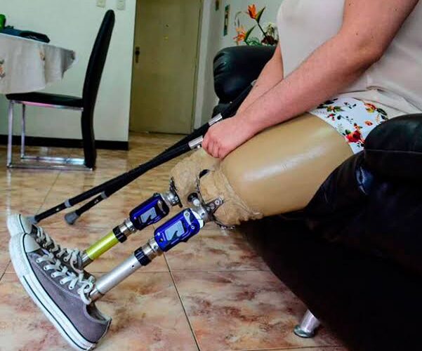 Ortopédico Infantil intensifica entrega de prótesis a niños lesionados por terremotos